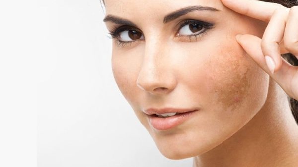 ترانگزامیک اسید دردرمان پوست-داریو درمان آرا