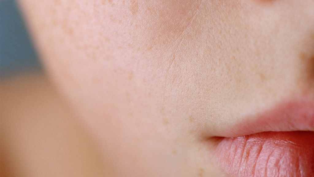 کم‌آبی پوست: چرا هیالورونیک اسید بهترین آبرسان دنیاست-داریو درمان آرا