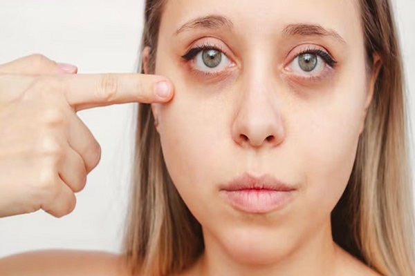 اثر کافئین در کاهش چین و چروک و پف زیر چشم-داریو درمان آرا