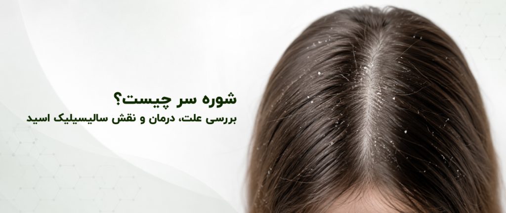 شوره سر چیست؟ بررسی علت، درمان و نقش سالیسیلیک اسید